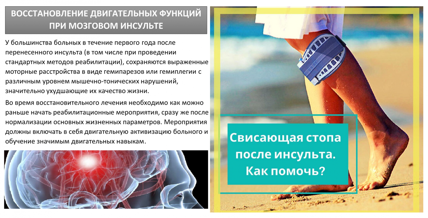 Восстановлении ходьбы после инсульта с ФЭС (обзор научной литературы) Восстановлении ходьбы после инсульта с ФЭС (обзор научной литературы)